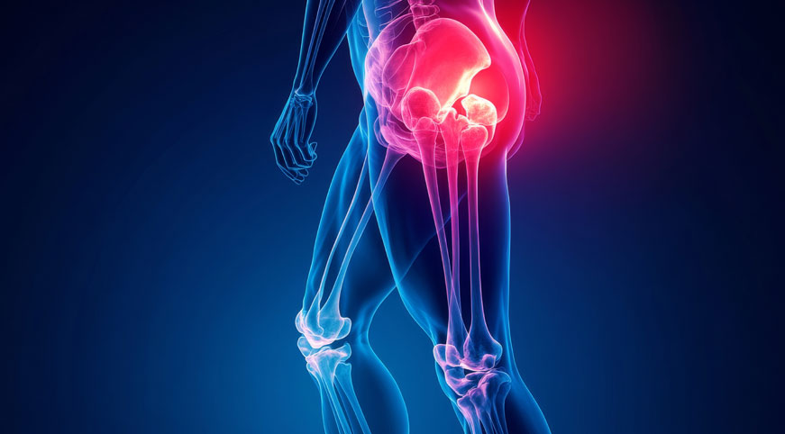 Understanding Hip Flexor Pain: Causes, Treatment, and Prevention